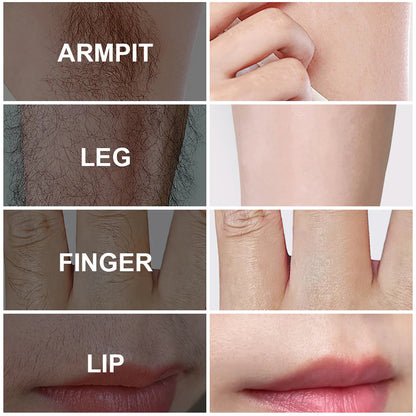 Fast-acting gentle hair removal cream